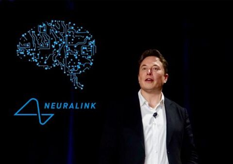 A finales de 2021 Neuralink podría implantar chips cerebrales